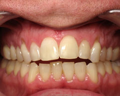 Orthodontic Treatment Case Study