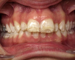 Orthodontic Treatment Case Study