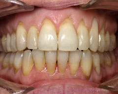 Orthodontic Treatment Case Study