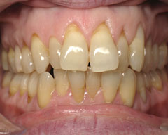 Orthodontic Treatment Case Study