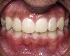 Orthodontic Treatment Case Study