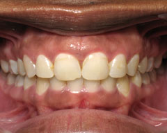 Orthodontic Treatment Case Study