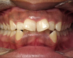 Orthodontic Treatment Case Study