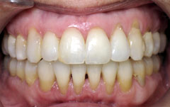 Orthodontic Treatment Case Study