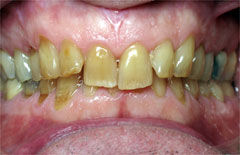 Orthodontic Treatment Case Study