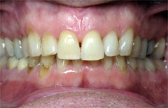 Orthodontic Treatment Case Study