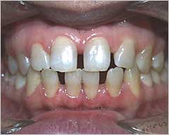 Orthodontic Treatment Case Study