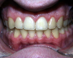 Orthodontic Treatment Case Study