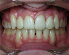 Orthodontic Treatment Case Study