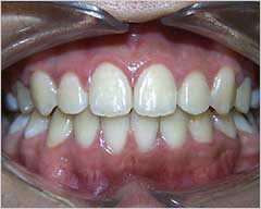 Orthodontic Treatment Case Study