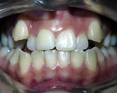 Orthodontic Treatment Case Study