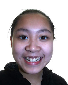 Orthodontic Treatment Case Study