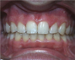 Orthodontic Treatment Case Study