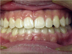 Orthodontic Treatment Case Study