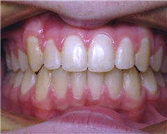 Orthodontic Treatment Case Study