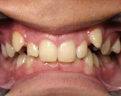 Orthodontic Treatment Case Study