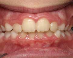 Orthodontic Treatment Case Study