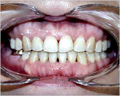 Orthodontic Treatment Case Study