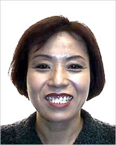 Orthodontic Treatment Case Study