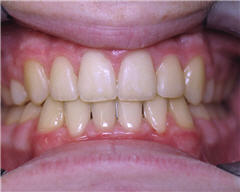 Orthodontic Treatment Case Study