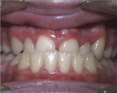 Orthodontic Treatment Case Study