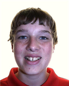 Orthodontic Treatment Case Study