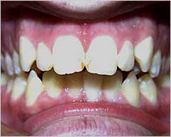 Orthodontic Treatment Case Study