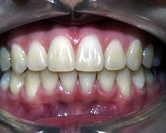 Orthodontic Treatment Case Study