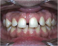 Orthodontic Treatment Case Study