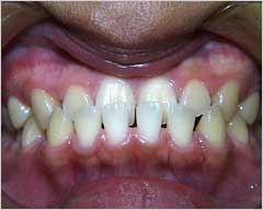 Orthodontic Treatment Case Study