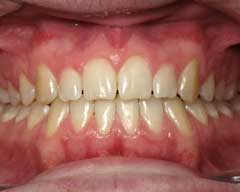 Orthodontic Treatment Case Study