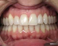 Orthodontic Treatment Case Study