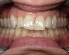 Orthodontic Treatment Case Study