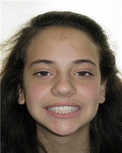 Orthodontic Treatment Case Study