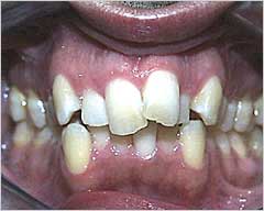 Orthodontic Treatment Case Study