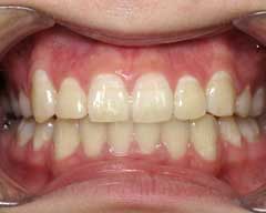 Orthodontic Treatment Case Study